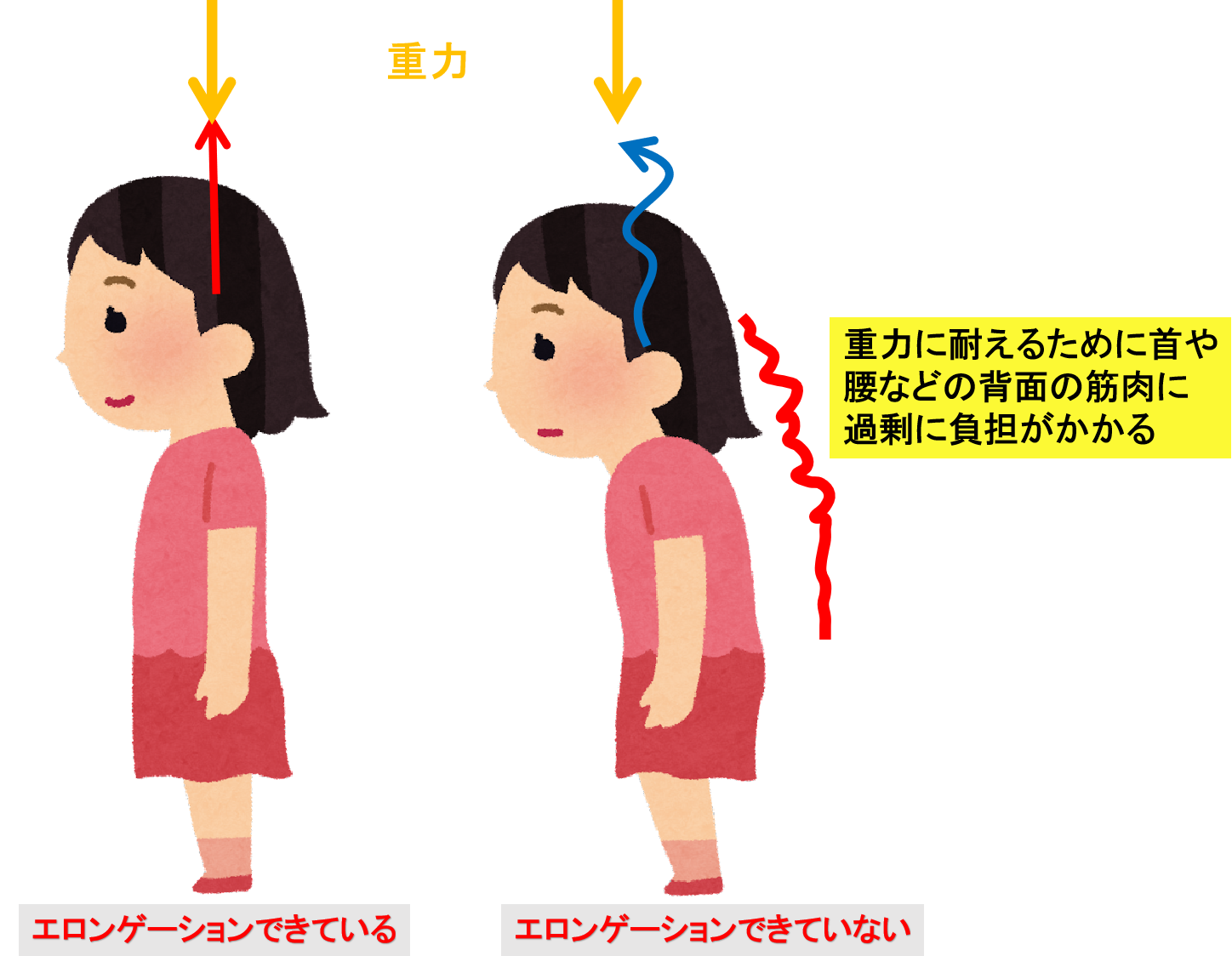 エロン ゲーション 意味